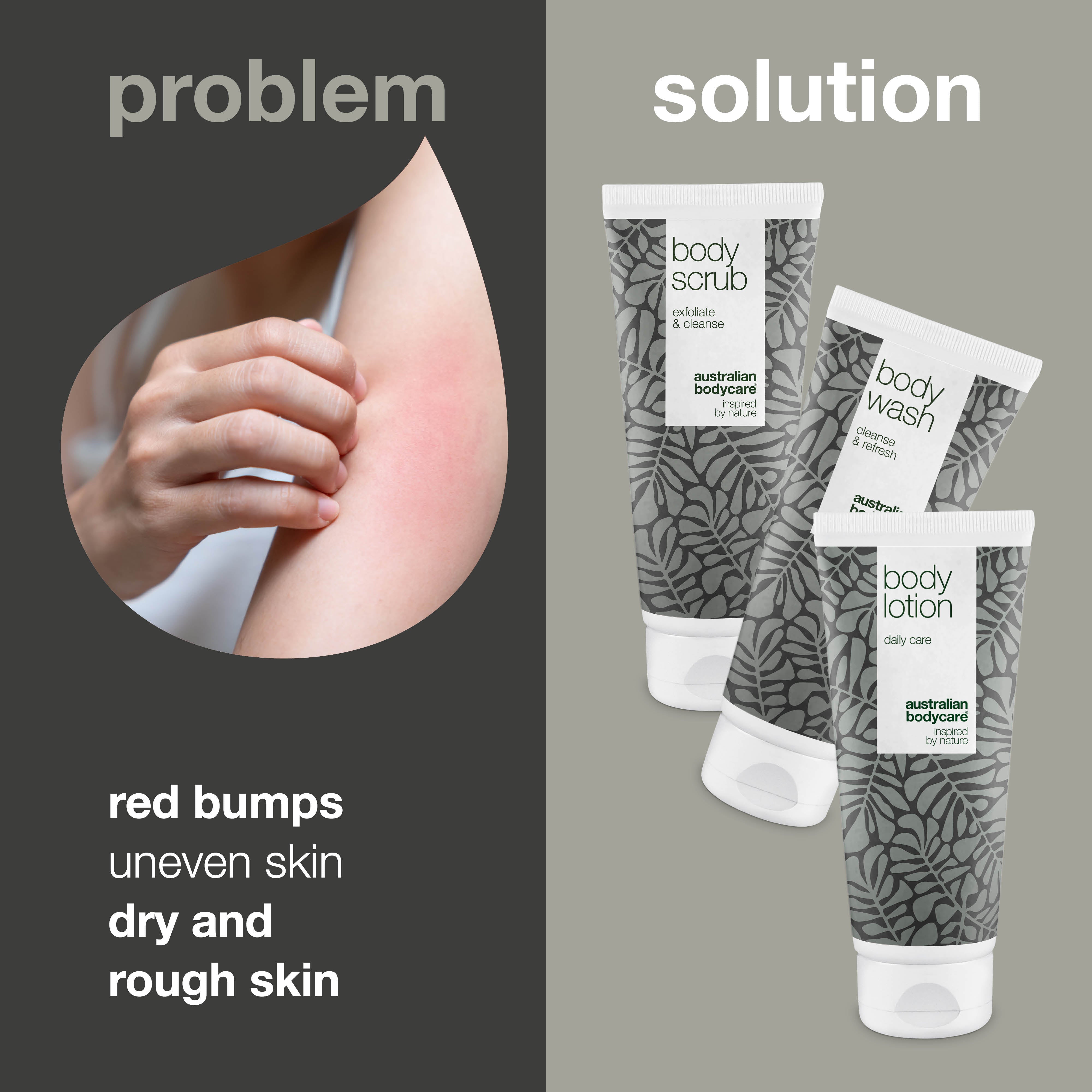 Keratosis pilaris -hoitopaketti — Pienet punaiset näpyt käsivarsilla tai reisillä? Hoitopaketti syväpuhdistaa, kosteuttaa ja hoitaa keratosis pilarista luonnollisesti. Sisältää luonnollisia aktiiveja.