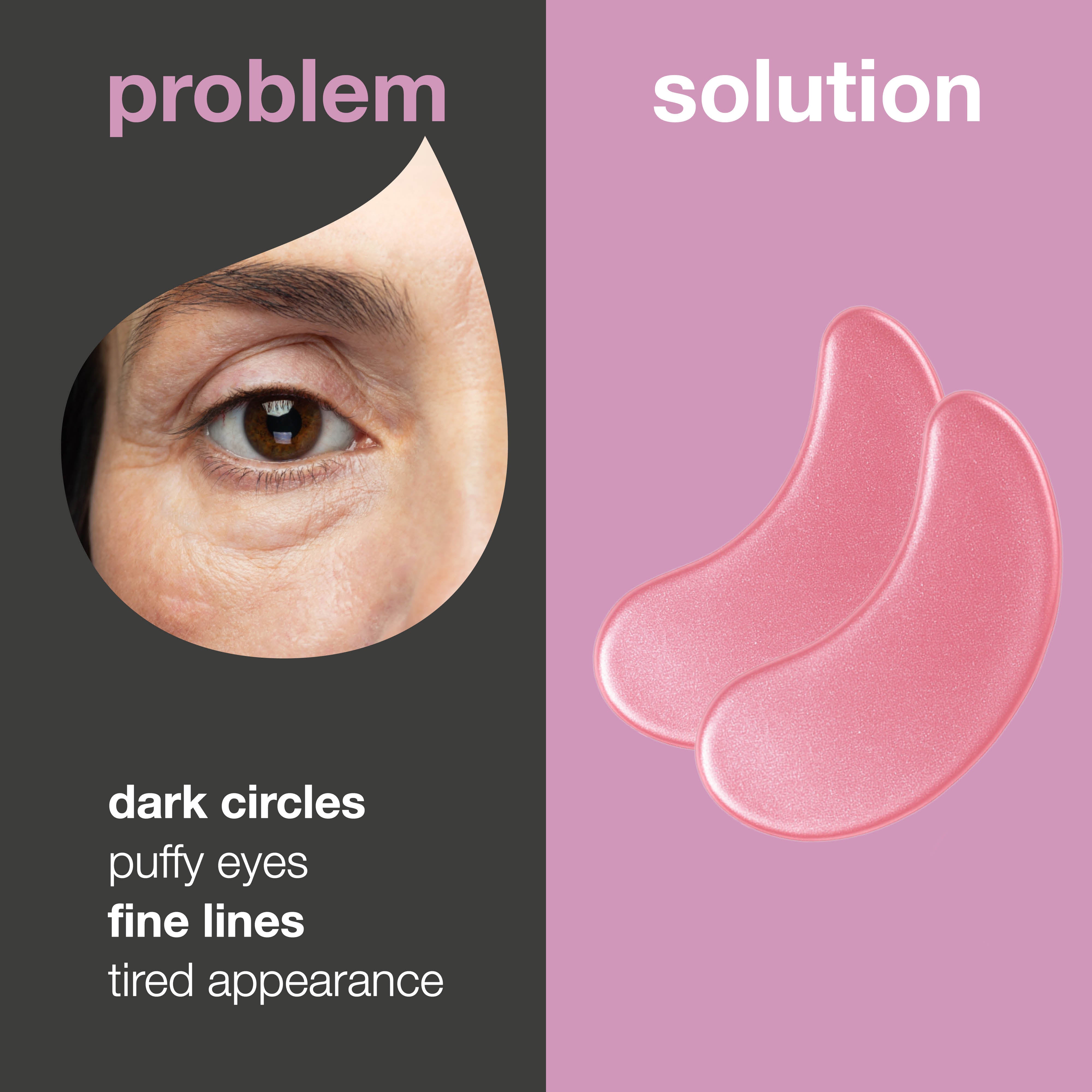 B12-vitamiinia sisältävät silmänaluslaput joissa on kollageeni turvotukseen — Vähennä tummia silmänalusia ja turvotusta B12-silmänympärysnaamioilla. Kosteuttaa ja virkistää ihoa vain 20 minuutissa!