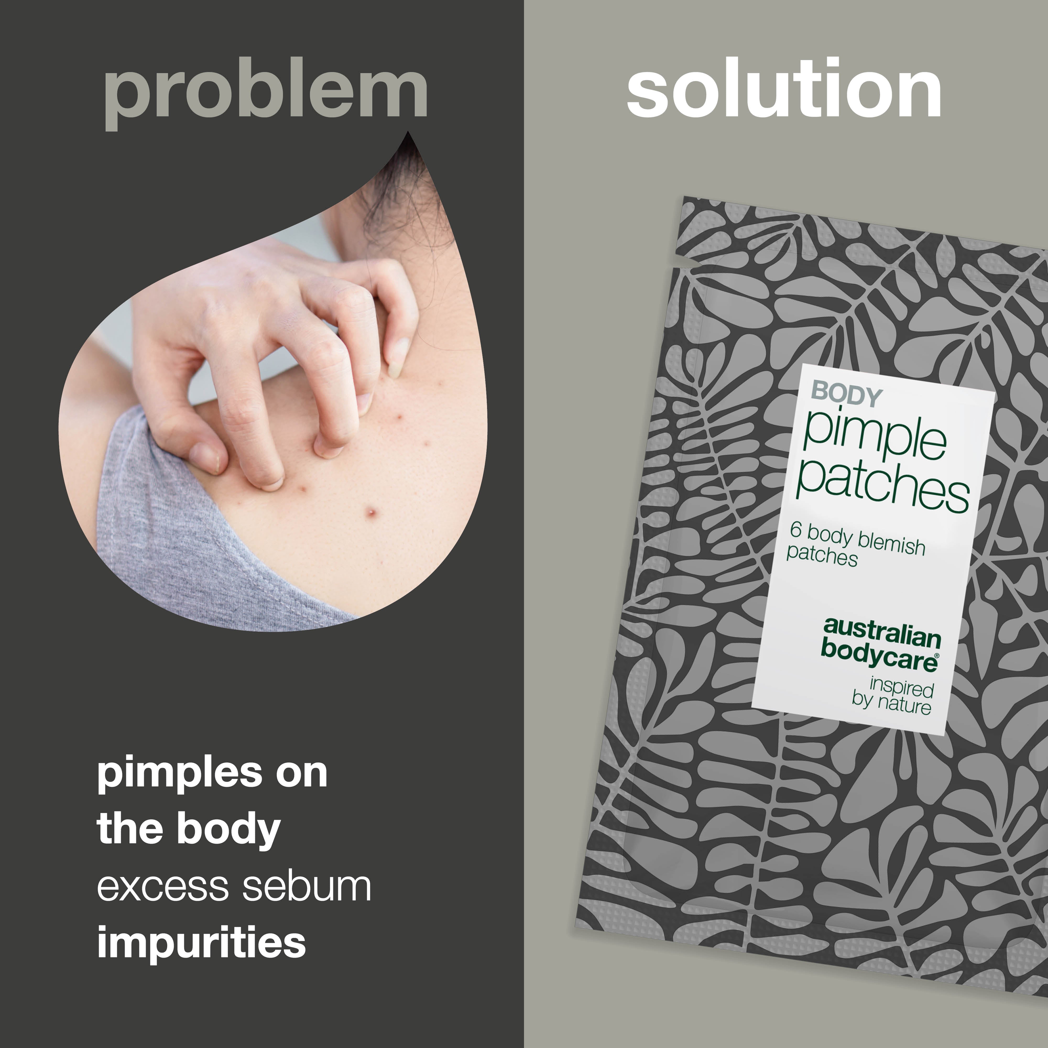 Body Pimple Patches – Näppylaastarit vartalolle — Poista näpyt selästä, rinnasta ja hartioilta. Laastarit imevät talin ja suojaavat ihoa bakteereilta.