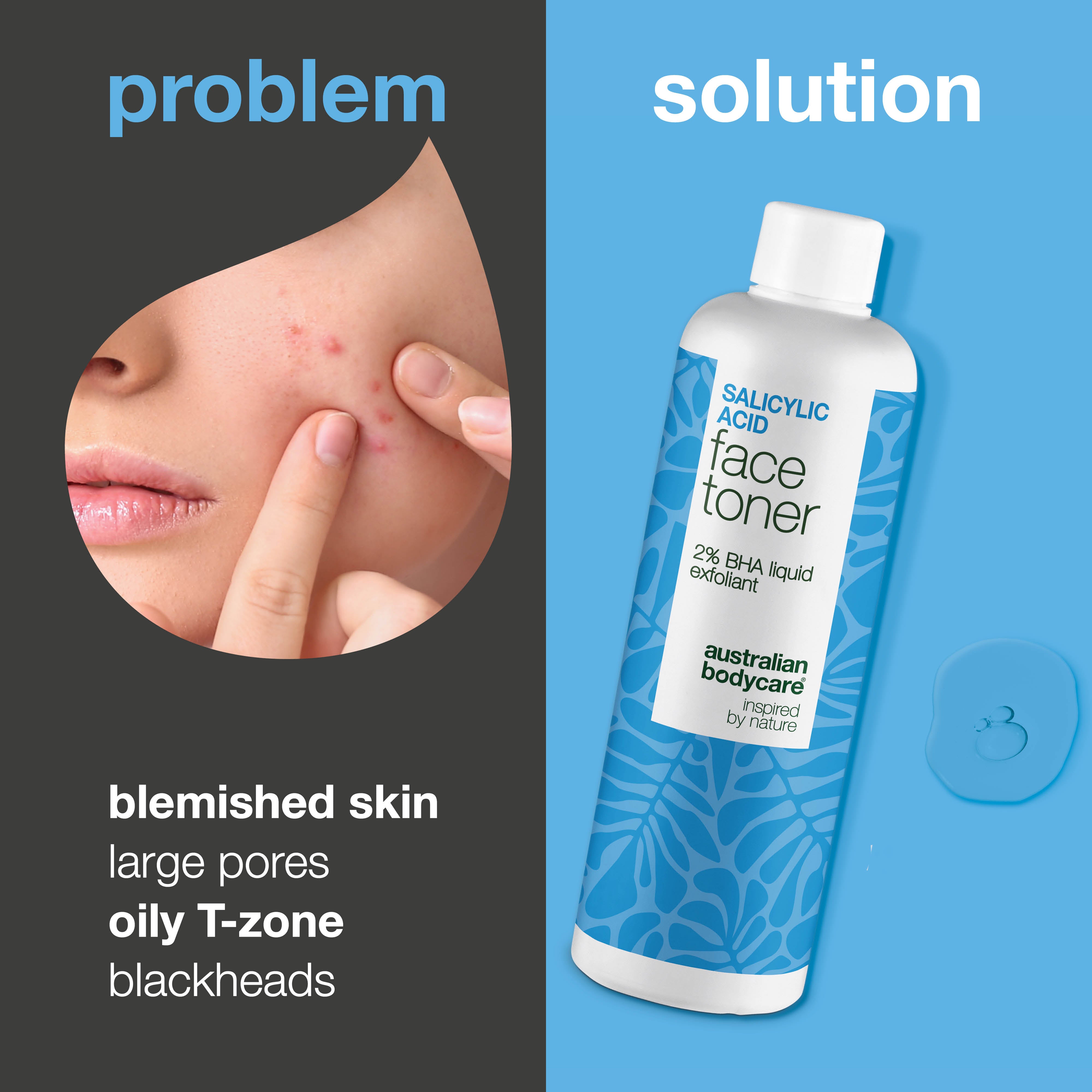 Salicylic Acid toner auttaa mustapäihin, epäpuhtauksiin ja epätasaiseen ihoon. Tehokas hoito. Sisältää Salicylic Acid – Australian Bodycare.