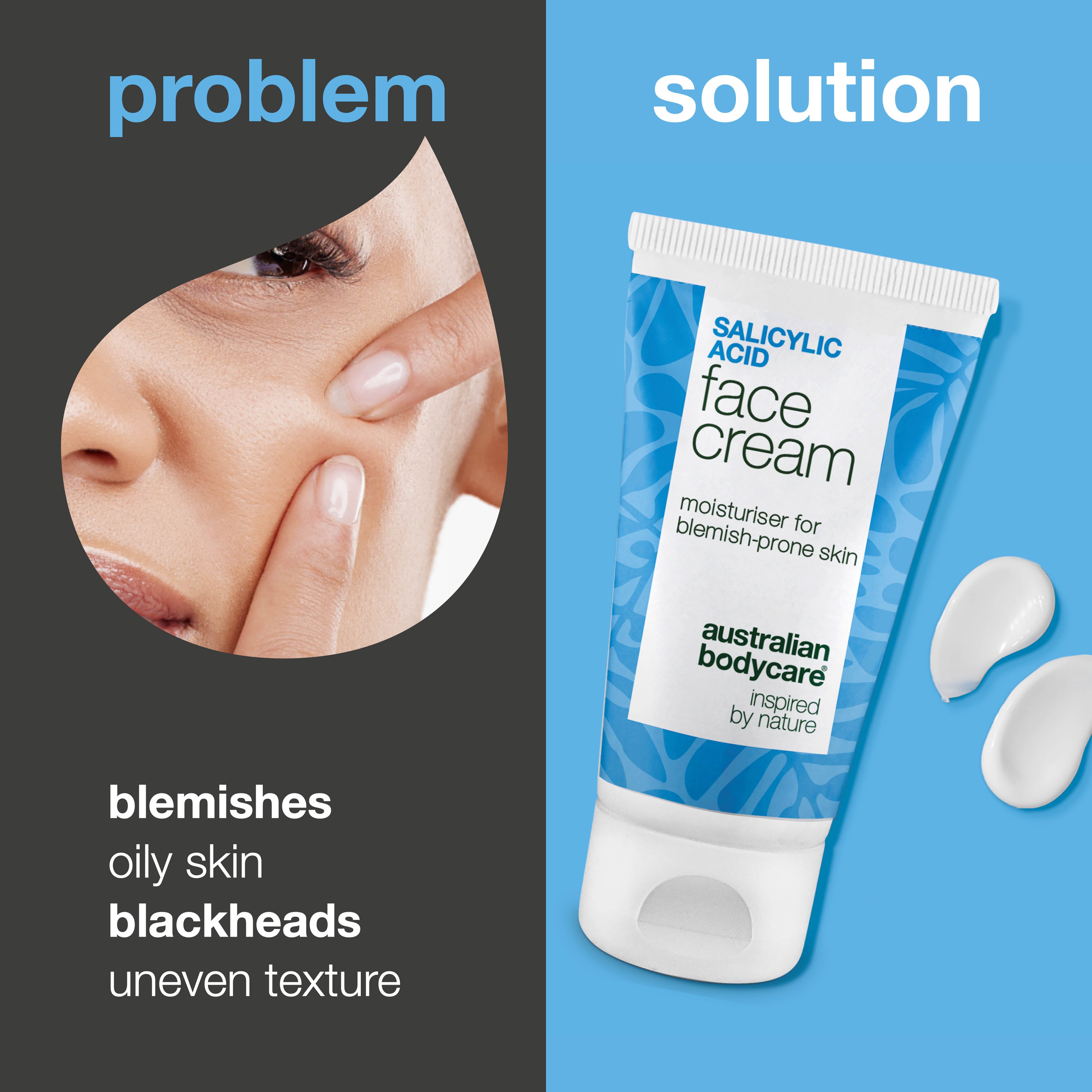 Kasvovoide salisyylihapolla näppyihin ja mustapäihin – puhdistaa ihohuokoset ja tasapainottaa rasvoittumista