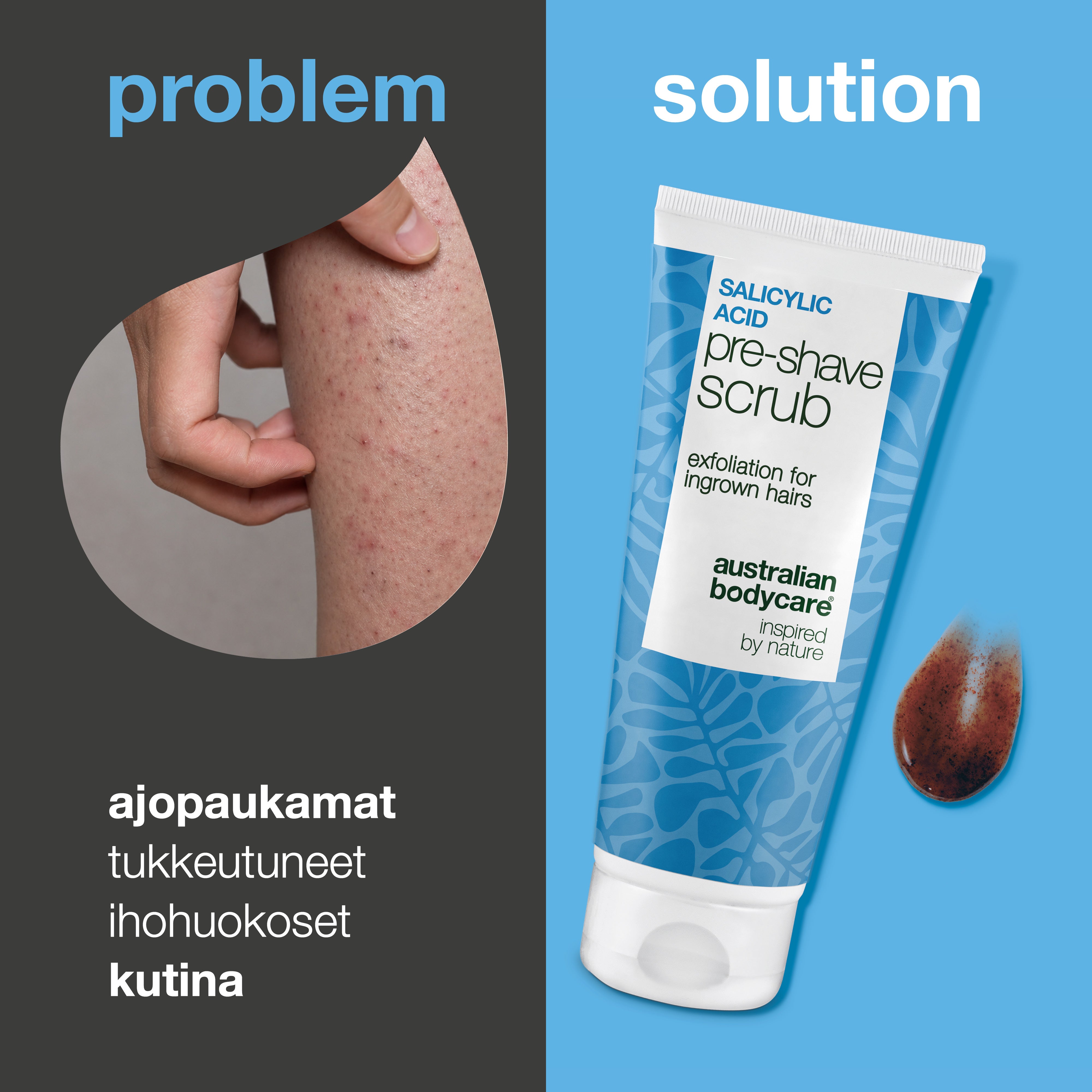 Salisyylihappo Pre-shave Scrub sisäänpäin kasvaville karvoille — Salisyylihappo Pre-shave Scrub sisäänpäin kasvaneille karvoille ja näpyille. Sileä ajo ilman kutinaa. Sisältää salisyylihappoa ja AHA-happoa.