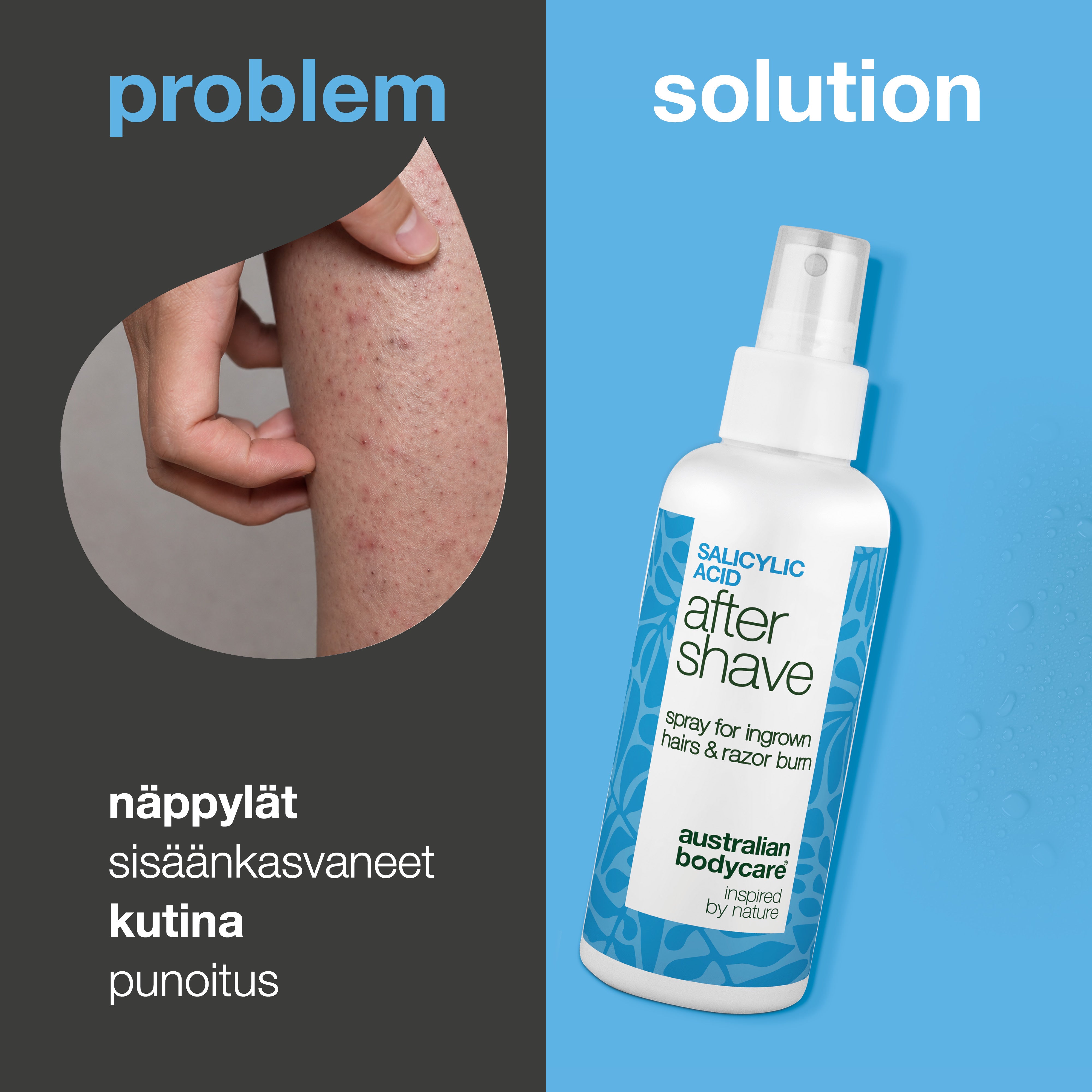 Salisyylihappo After Shave suihke näppylöihin — After Shave suihke näppylöihin ja sisäänkasvaneille karvoille. Salisyylihappo ja Aloe Vera rauhoittavat kutinaa. Kokeile heti!