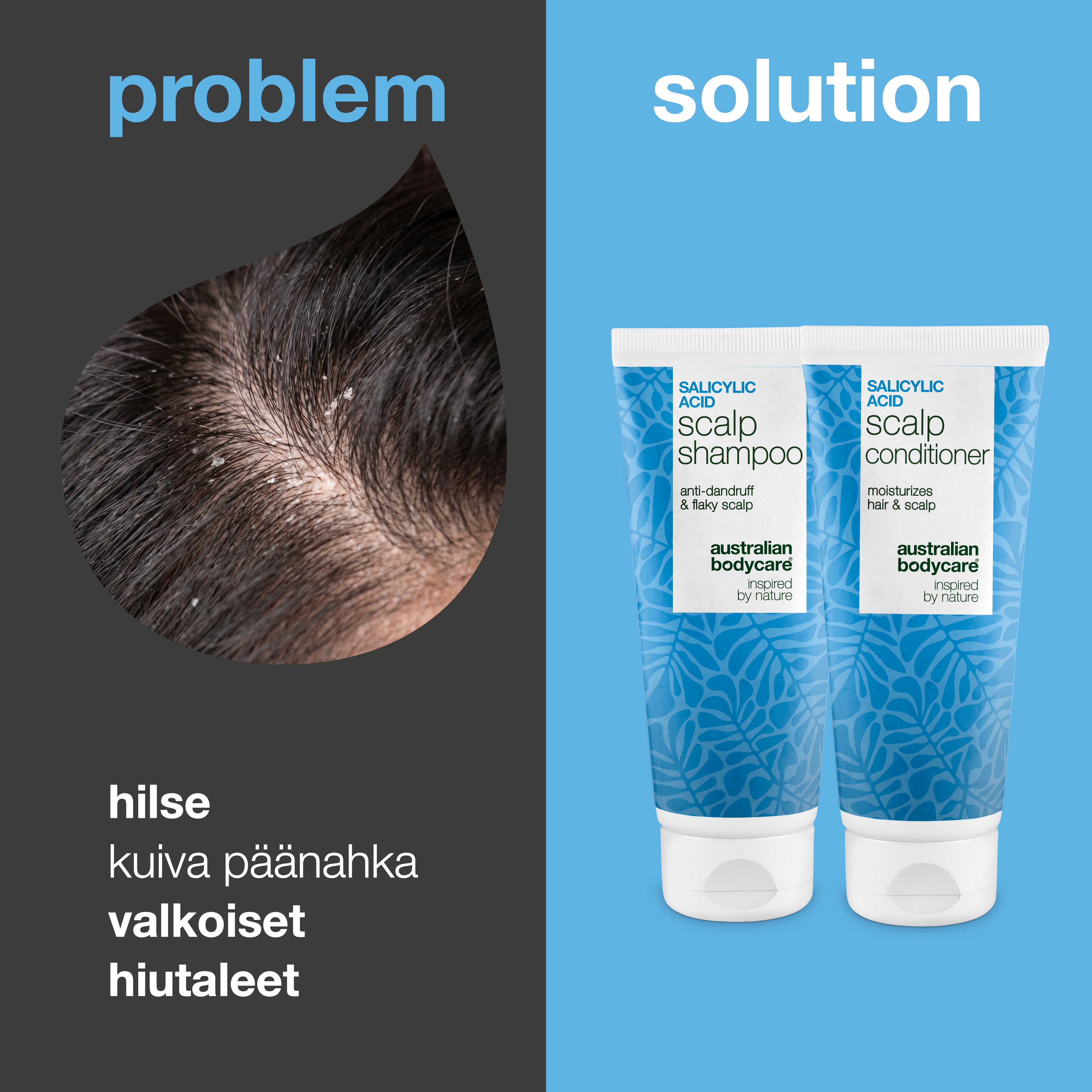 Ongelma ja ratkaisu: lähikuva hilseestä ja valkoisista hiutaleista päänahassa sekä setin shampoo ja hoitoaine