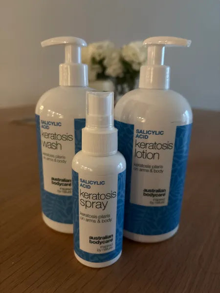 Asiakkaan tulos keratosis pilaris – Walter P.